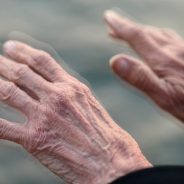 Há um novo medicamento para doentes com Parkinson disponível em Portugal